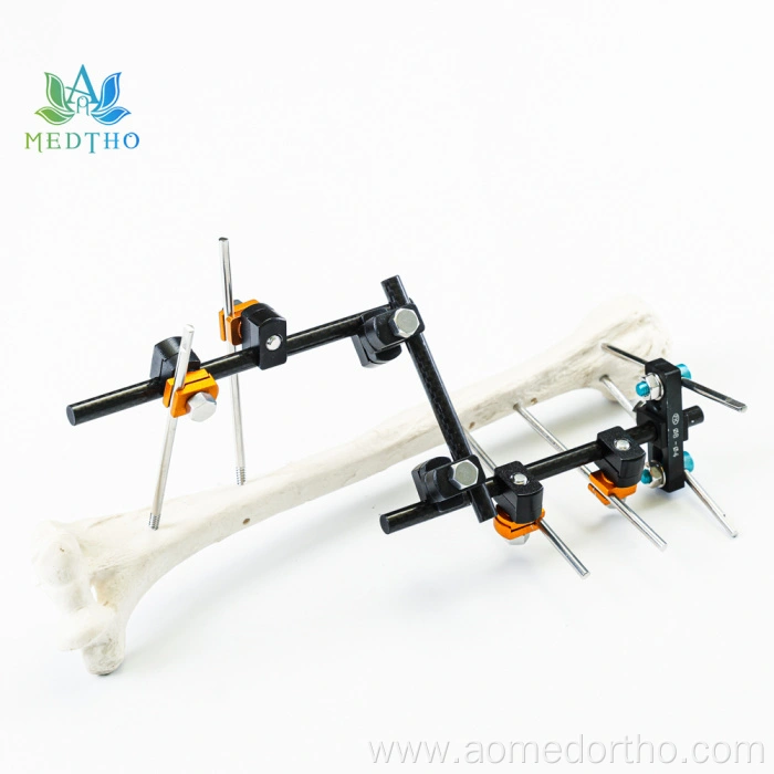 humerus fracture treatment